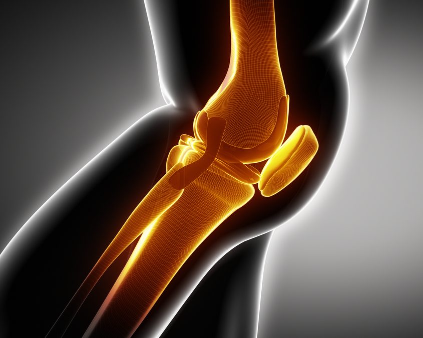 ACL Injury in Female Athletes